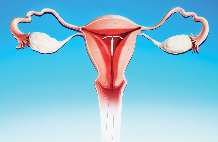 Warren Buffett’s Family Secretly Funded a Birth Control Revolution