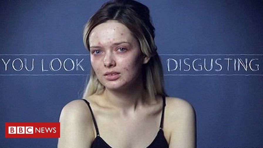 Beauty blogger shames bullies