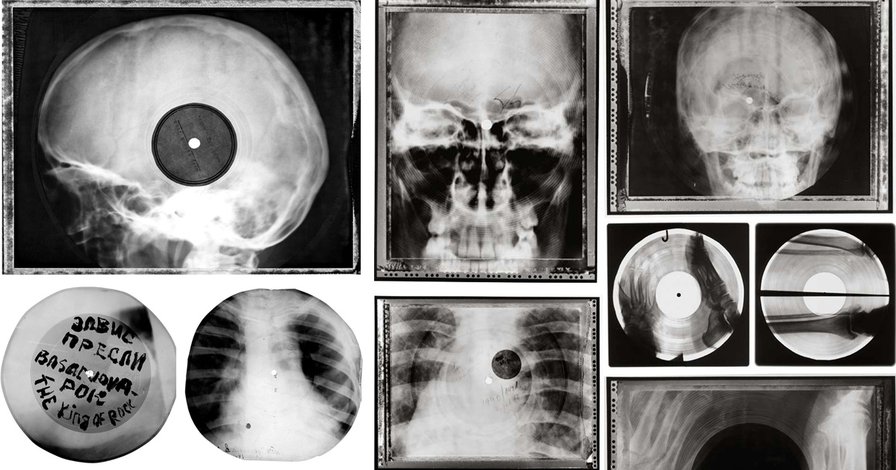 Bone Music: Banned Western Music printed on Soviet X-Rays